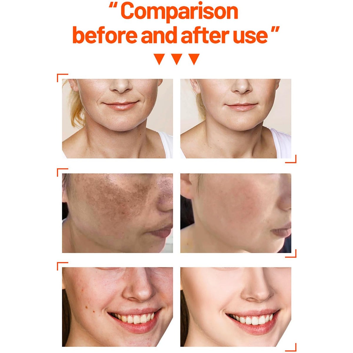 Set Vitamina C Naranja Brillante
